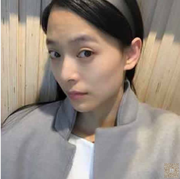 做le超 声 波去眼袋,熬夜也不怕 做le超 声 波去眼袋,熬夜也不怕