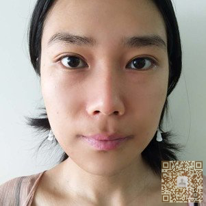 超声波瘦脸效果真的棒极了791