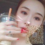 超声波双眼皮手术让挑剔的我也能超满意547 超声波双眼皮手术让挑剔的我也能超满意547