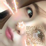 超声波双眼皮手术让挑剔的我也能超满意547 超声波双眼皮手术让挑剔的我也能超满意547