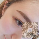 超声波双眼皮手术让挑剔的我也能超满意547 超声波双眼皮手术让挑剔的我也能超满意547