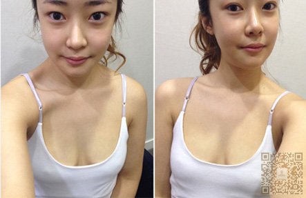 女人的事业线来自超声波丰胸042 女人的事业线来自超声波丰胸042