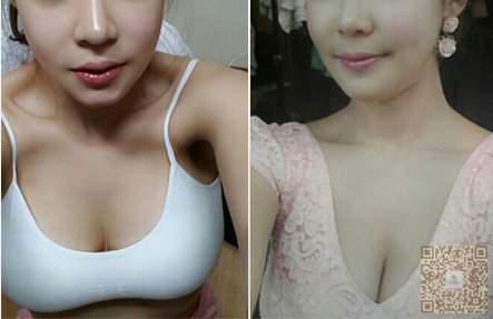 女人的事业线来自超声波丰胸042 女人的事业线来自超声波丰胸042