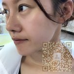 精致小鼻子来自超雅不开刀隆鼻手术850 精致小鼻子来自超雅不开刀隆鼻手术850