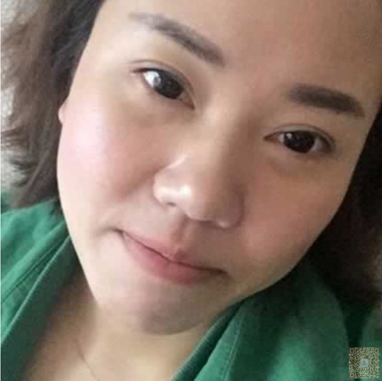想要瘦脸就做超声波瘦脸手术吧542 想要瘦脸就做超声波瘦脸手术吧542