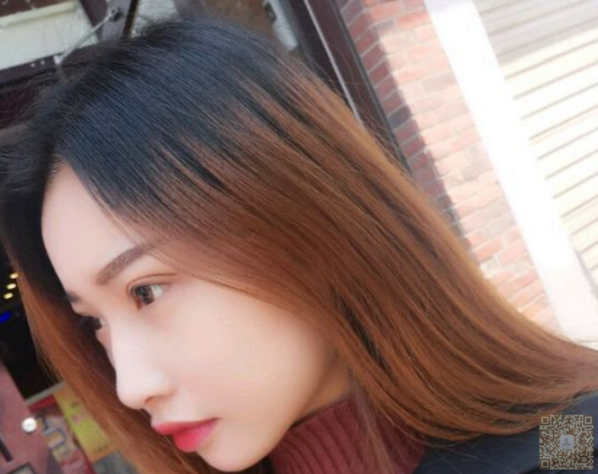 超 声 波去眼袋,让你美丽加分 超 声 波去眼袋,让你美丽加分