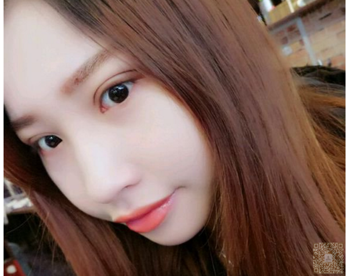 超 声 波去眼袋,让你美丽加分 超 声 波去眼袋,让你美丽加分