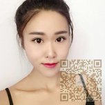 喜欢超雅的超声波双眼皮手术619 喜欢超雅的超声波双眼皮手术619