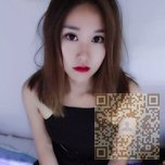喜欢超雅的超声波双眼皮手术619 喜欢超雅的超声波双眼皮手术619