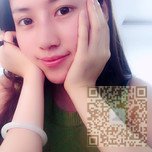 鼻子好看了?都是超雅不开刀隆鼻的功劳466 鼻子好看了?都是超雅不开刀隆鼻的功劳466