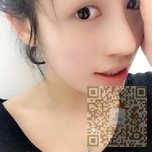 鼻子好看了?都是超雅不开刀隆鼻的功劳466 鼻子好看了?都是超雅不开刀隆鼻的功劳466