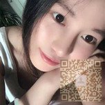 鼻子好看了?都是超雅不开刀隆鼻的功劳466 鼻子好看了?都是超雅不开刀隆鼻的功劳466
