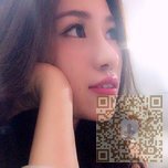 鼻子好看了?都是超雅不开刀隆鼻的功劳466 鼻子好看了?都是超雅不开刀隆鼻的功劳466