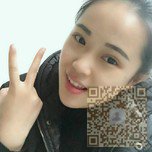 选择超雅超声波双眼皮手术不后悔848 选择超雅超声波双眼皮手术不后悔848