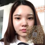 超雅超 声 波双眼 皮让wǒ自信前行 超雅超 声 波双眼 皮让wǒ自信前行