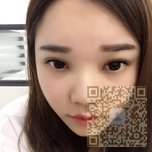 超雅超 声 波双眼 皮让wǒ自信前行 超雅超 声 波双眼 皮让wǒ自信前行