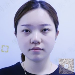 超雅超 声 波双眼 皮让wǒ自信前行 超雅超 声 波双眼 皮让wǒ自信前行