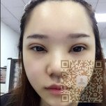 超雅超 声 波双眼 皮让wǒ自信前行 超雅超 声 波双眼 皮让wǒ自信前行