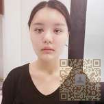 超声波自体脂肪丰面手术后变回甜美少女870 超声波自体脂肪丰面手术后变回甜美少女870
