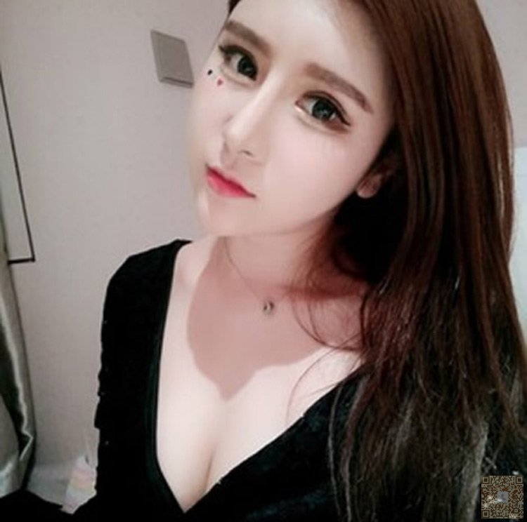 想看我超声波双眼皮之后效果的请进247 想看我超声波双眼皮之后效果的请进247