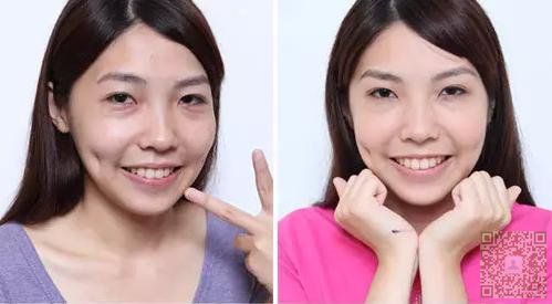 要变年轻怎离得开超雅超声波去眼袋716 要变年轻怎离得开超雅超声波去眼袋716