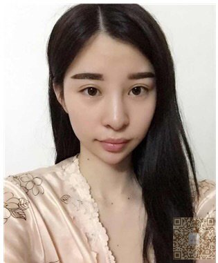 富太太做了超声波去眼袋以后越来越美967 富太太做了超声波去眼袋以后越来越美967
