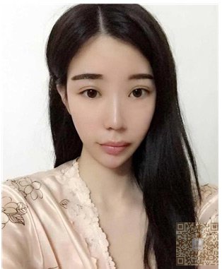 富太太做了超声波去眼袋以后越来越美967 富太太做了超声波去眼袋以后越来越美967