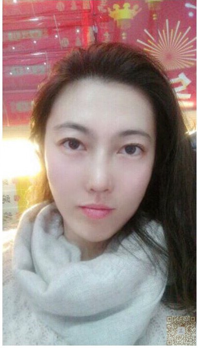 超声波去眼袋让我看上去精明多了599 超声波去眼袋让我看上去精明多了599
