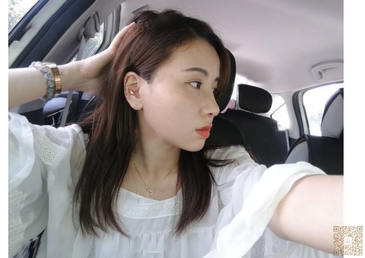 鼻子矮矮的怎么办?去超雅做不开刀隆鼻908 鼻子矮矮的怎么办?去超雅做不开刀隆鼻908