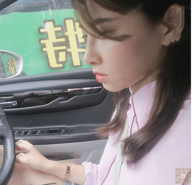 鼻子矮矮的怎么办?去超雅做不开刀隆鼻908 鼻子矮矮的怎么办?去超雅做不开刀隆鼻908