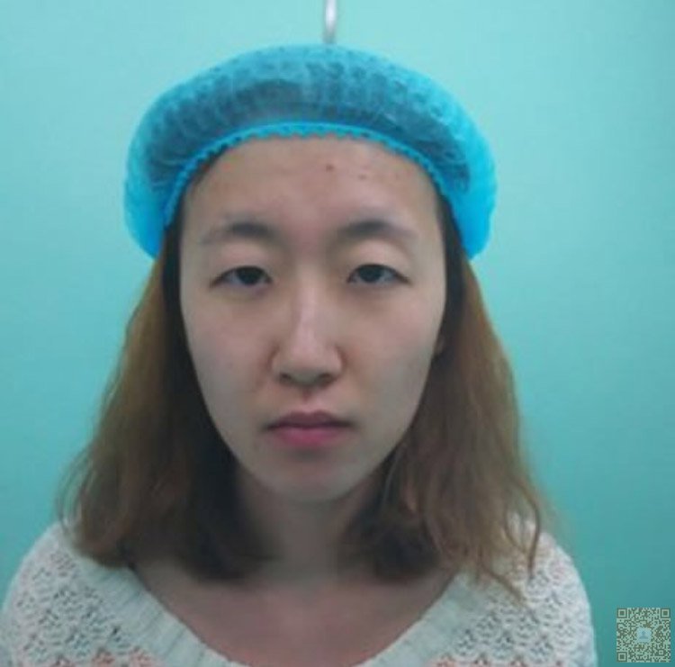超声波瘦脸让我和老公又恩爱了144 超声波瘦脸让我和老公又恩爱了144