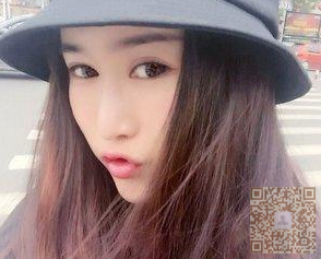 不开刀隆鼻后，瞬间觉得自己精神了很多560