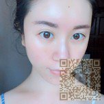 超声波自体脂肪丰面手术还你年轻容颜453 超声波自体脂肪丰面手术还你年轻容颜453