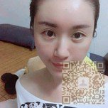 超声波自体脂肪丰面手术还你年轻容颜453 超声波自体脂肪丰面手术还你年轻容颜453