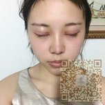 在超雅做超声波双眼皮棒呆了066 在超雅做超声波双眼皮棒呆了066