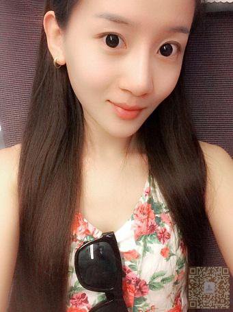 超声波去双下巴以后真的没有双下巴了啊787 超声波去双下巴以后真的没有双下巴了啊787