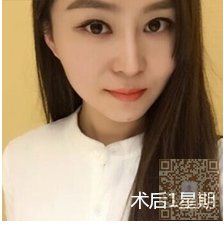 做超声波去双下巴让人看上去年轻004 做超声波去双下巴让人看上去年轻004