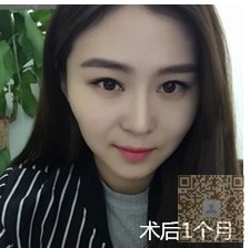 做超声波去双下巴让人看上去年轻004 做超声波去双下巴让人看上去年轻004