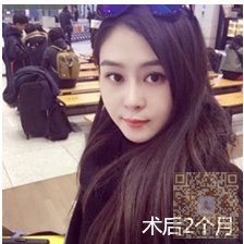 做超声波去双下巴让人看上去年轻004 做超声波去双下巴让人看上去年轻004