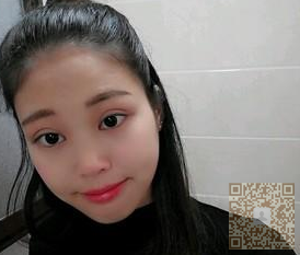 超声波双眼皮后,记录下962 超声波双眼皮后,记录下962