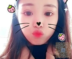 超声波双眼皮后,记录下962 超声波双眼皮后,记录下962