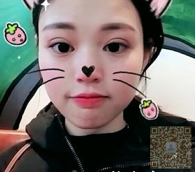 超声波双眼皮后,记录下962 超声波双眼皮后,记录下962