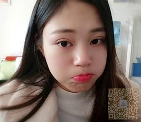 超声波双眼皮后,记录下962 超声波双眼皮后,记录下962