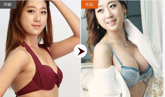 超声波丰胸让我的世界重见光明142 超声波丰胸让我的世界重见光明142
