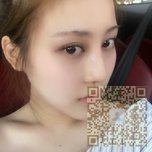 感谢超雅得不开刀隆鼻手术让wǒ有这么挺翘得鼻子 感谢超雅得不开刀隆鼻手术让wǒ有这么挺翘得鼻子