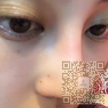 感谢超雅得不开刀隆鼻手术让wǒ有这么挺翘得鼻子 感谢超雅得不开刀隆鼻手术让wǒ有这么挺翘得鼻子