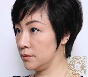 超声波去双下巴帮我顺利解决双下巴哦969 超声波去双下巴帮我顺利解决双下巴哦969