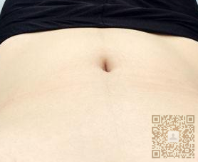 想要瘦肚子得盆友们，快来看看wǒ做得超 声 波减肥哦
