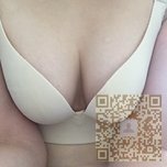 超声波自体脂肪丰胸就是很美丽呀670 超声波自体脂肪丰胸就是很美丽呀670