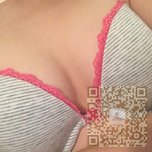 超声波自体脂肪丰胸就是很美丽呀670 超声波自体脂肪丰胸就是很美丽呀670